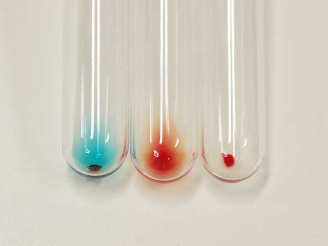 予防接種・血液検査